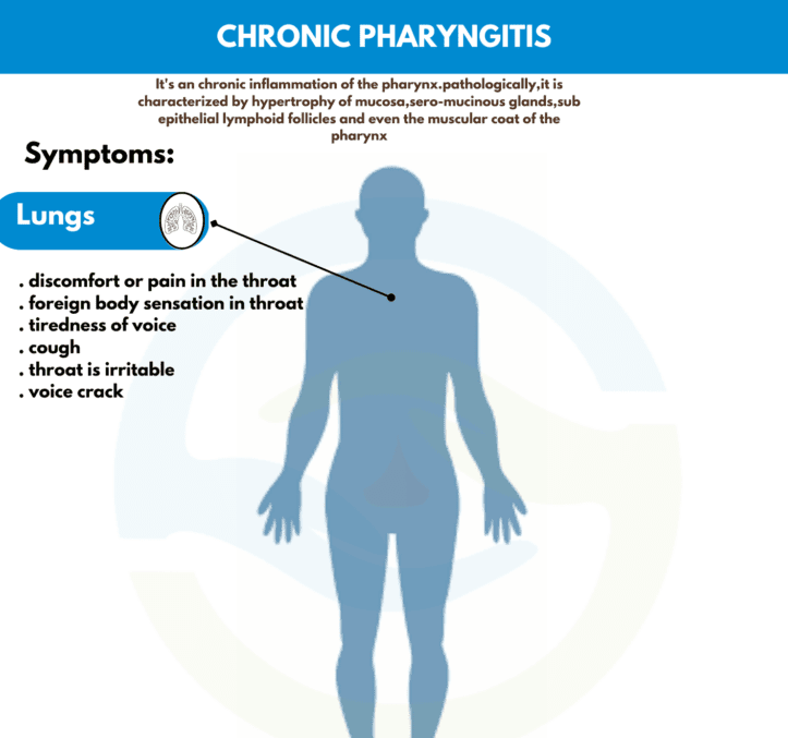 Causes of Chronic Pharyngitis: What You Need to Know!